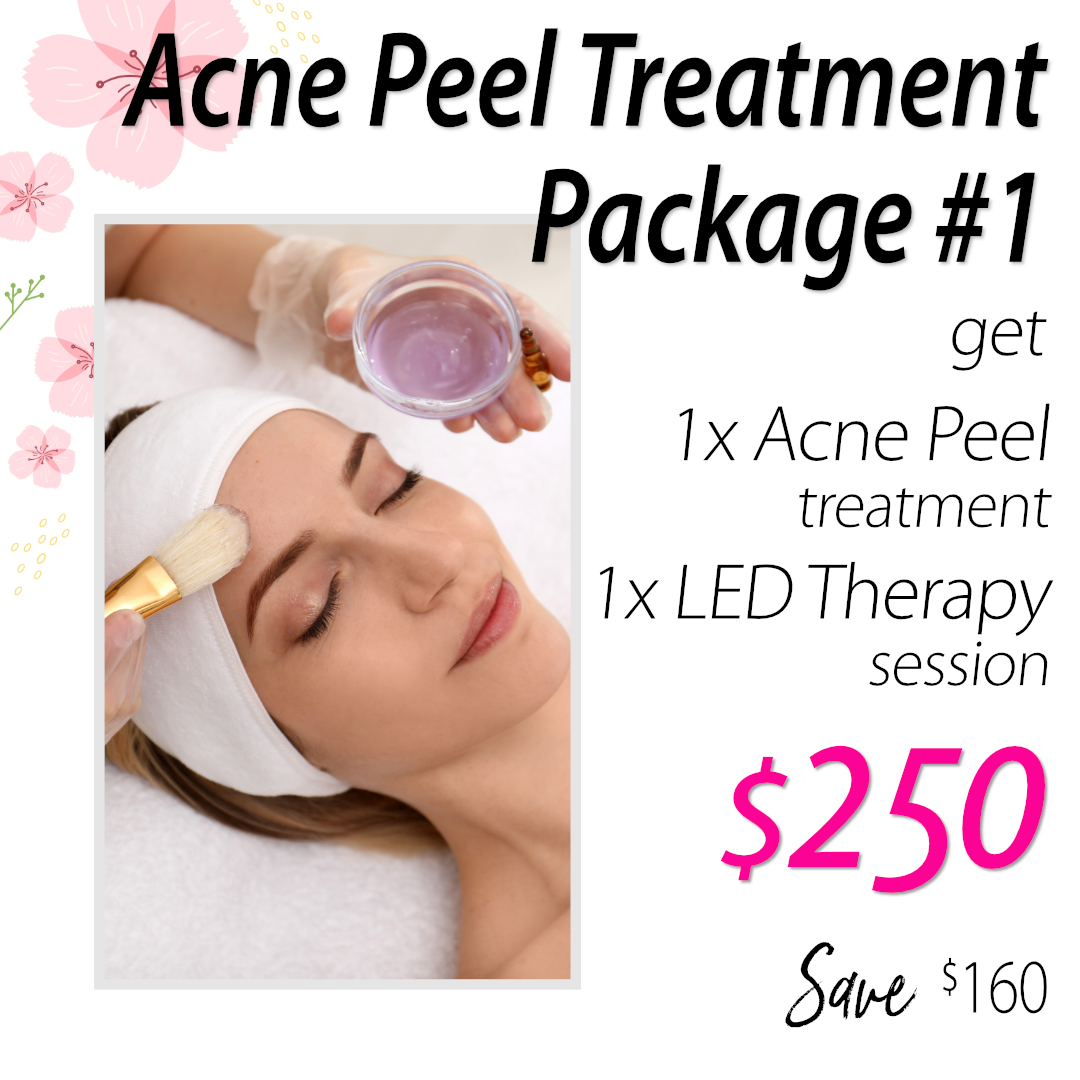 Acne Peel Treatment Packages: Package 1 $250 – Includes 1 Acne Peel + FREE LED Therapy ($110 Value)