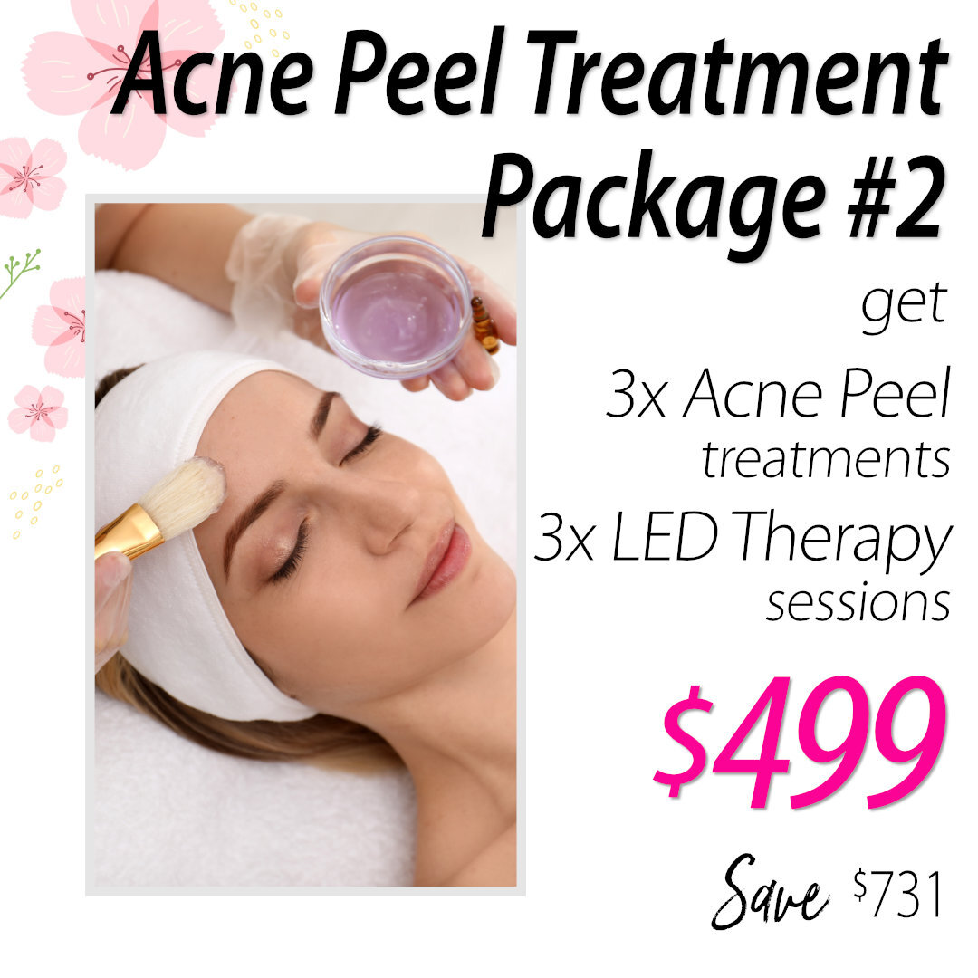 Acne Peel Treatment Packages: Package 2 $499 – Includes 3 Acne Peels (worth $900) + FREE 3x LED Therapy ($330 Value)