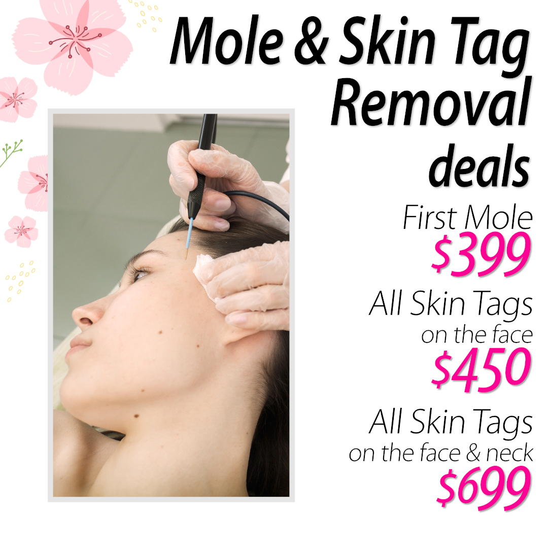 Mole & Skin Tag Removal - from $399