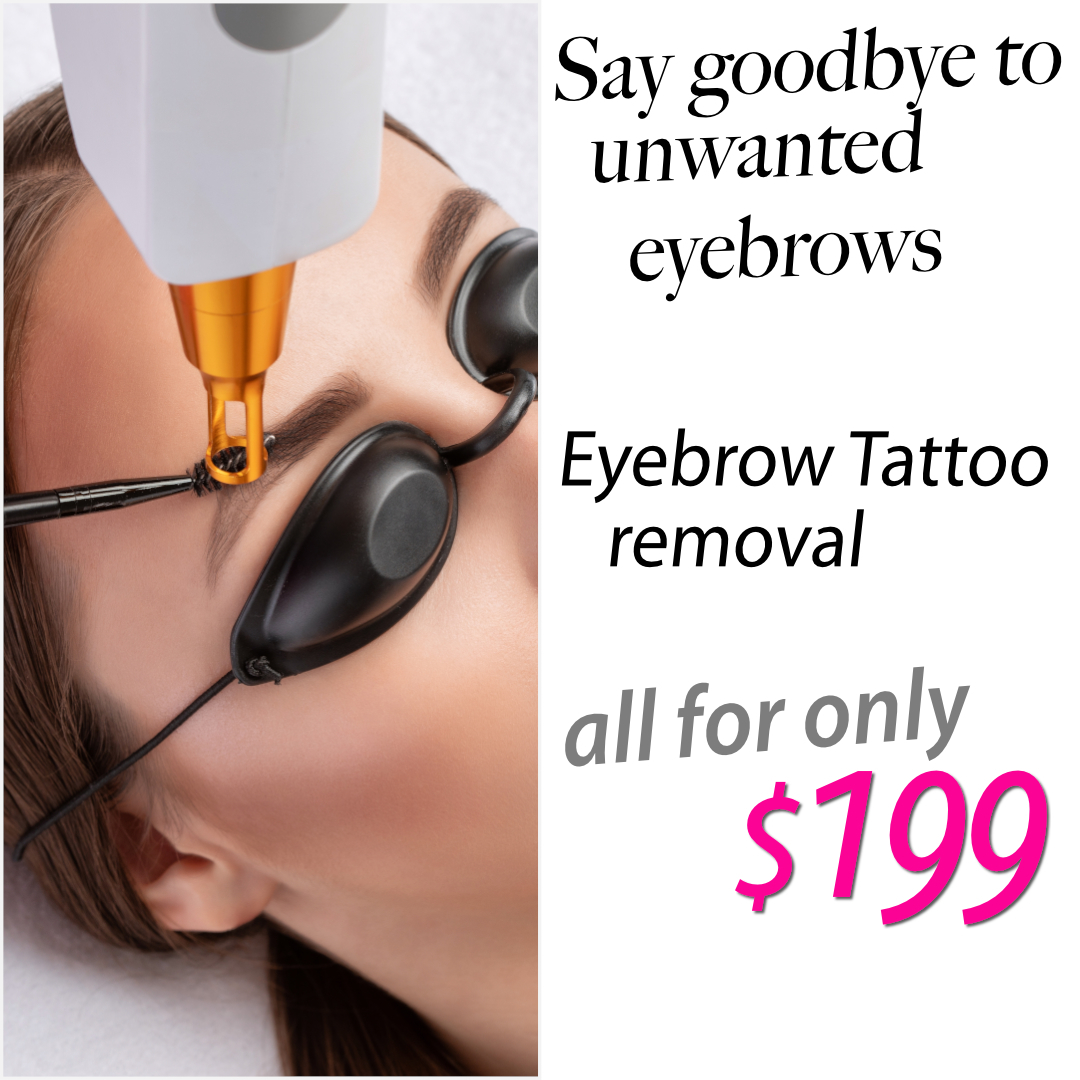 Say goodbye to unwanted eyebrow tattoos with our professional tattoo removal service for just $199.