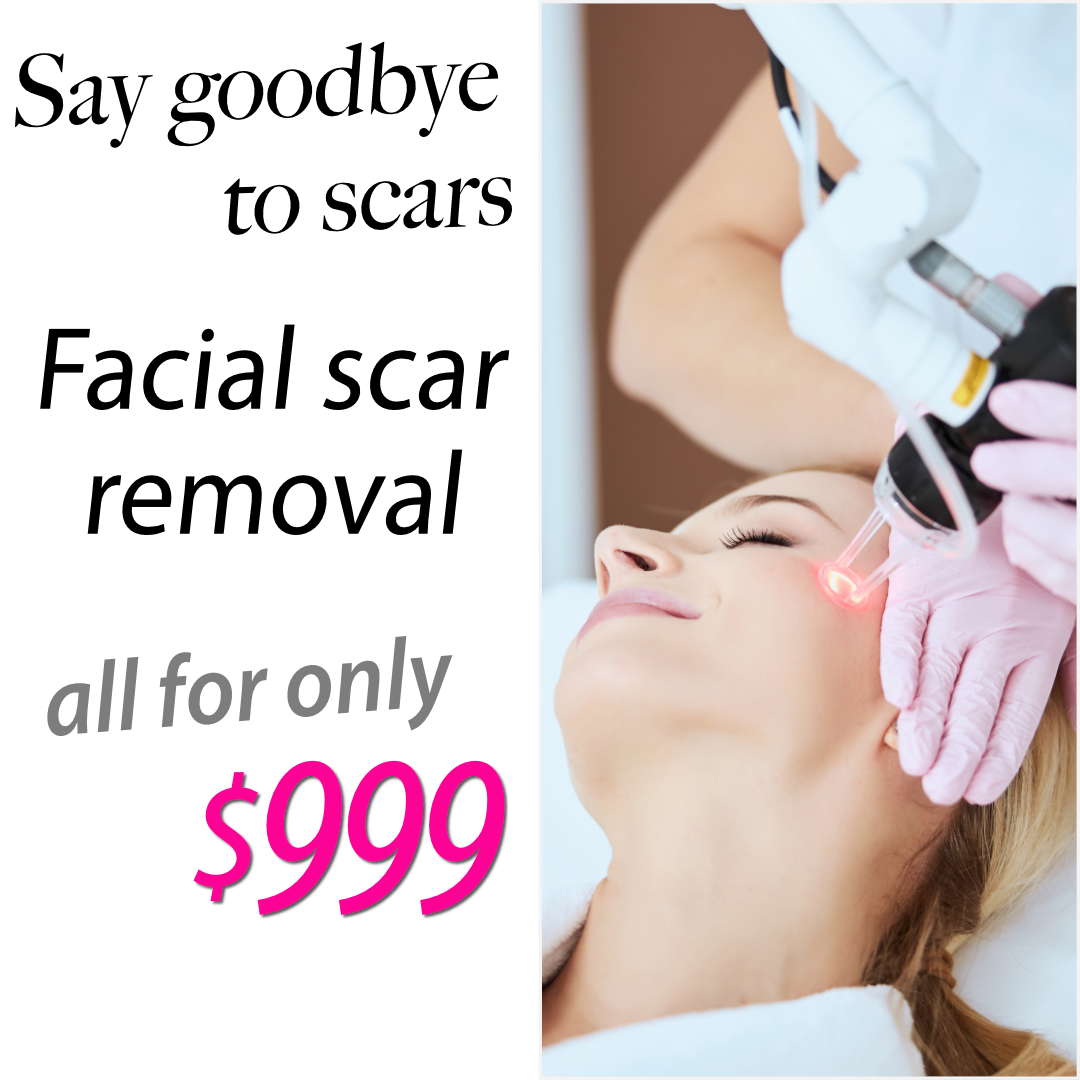 Unlock your best skin with our exclusive promotion on Scar Removal Face Treatment using advanced CO2 Laser technology, now for just $999!