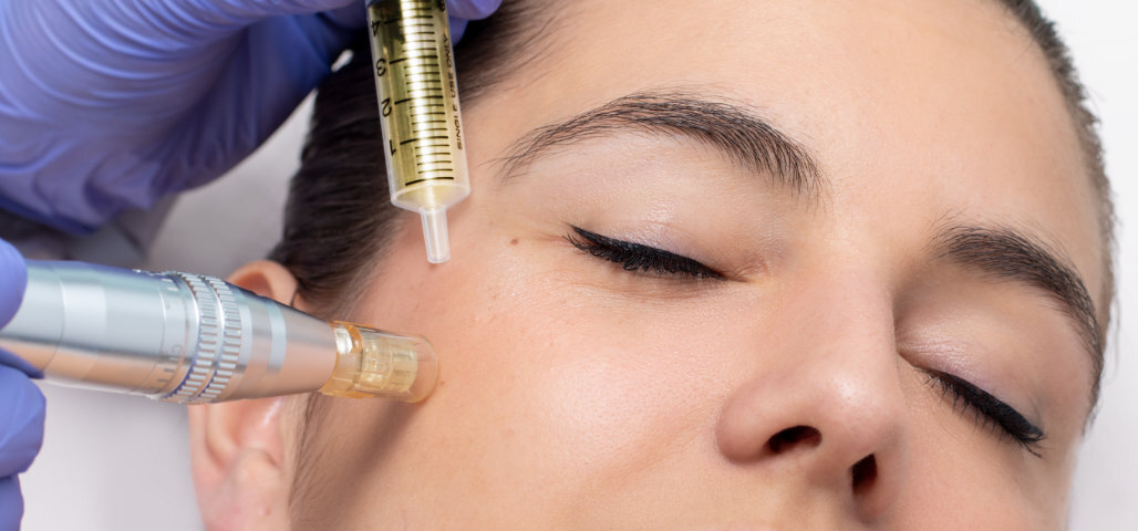 Microneedling’s magic lies in stimulating fibroblasts — the skin cells responsible for producing collagen and elastin.