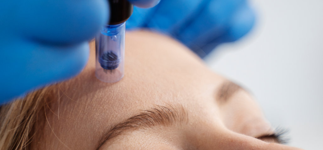 Factors such as age, skin condition, and aftercare influence how quickly and dramatically results appear.