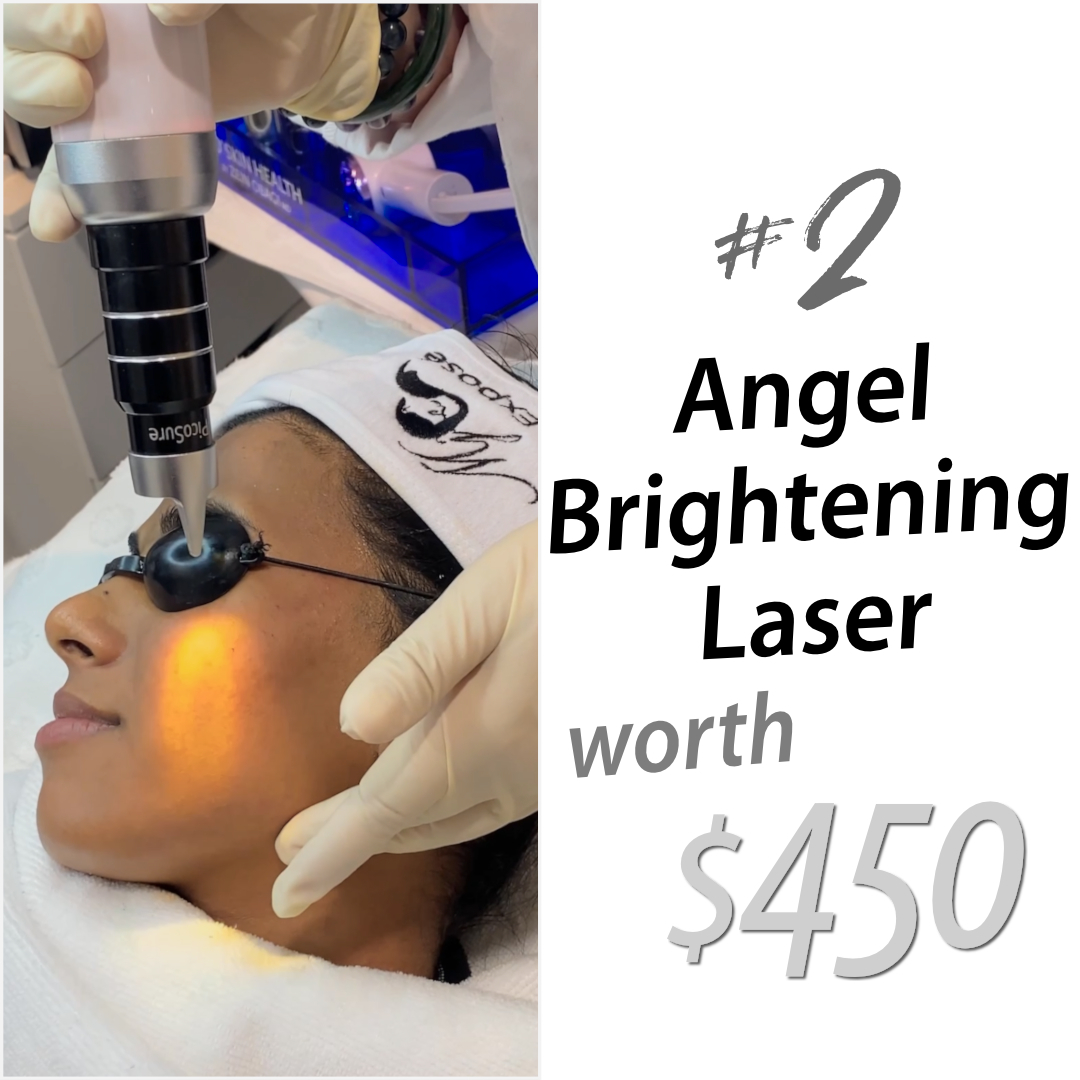 Angel Brightening Laser - RRP $450