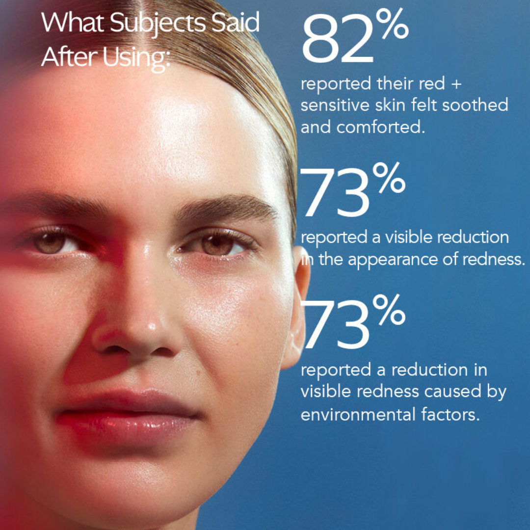 An independent, third parry clinical study of 22 subjects to assess the efficacy potential of Rozatrol® in minimizing the signs and symptoms of rosaces.