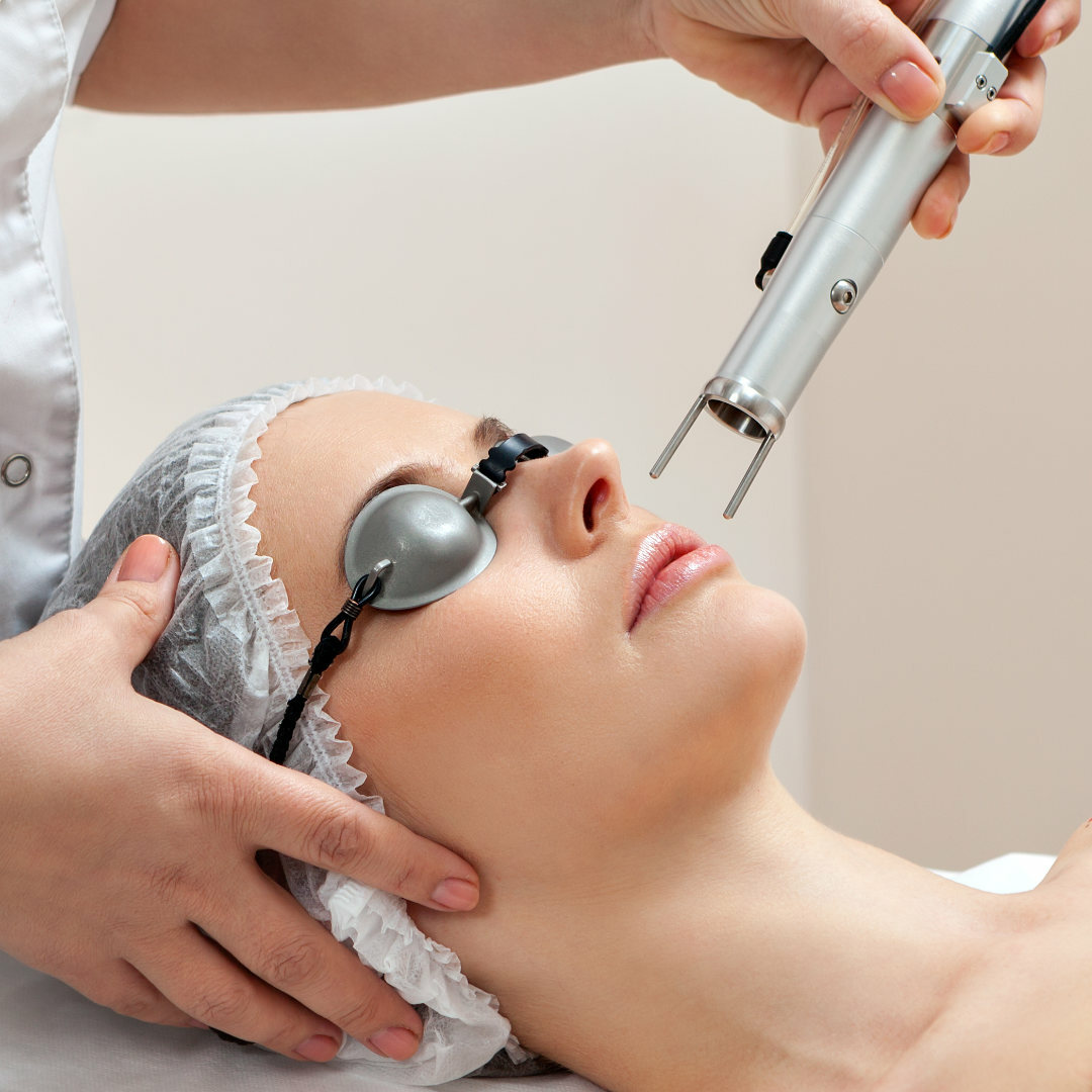 Angel White Laser is a state-of-the-art treatment that targets pigmentation, sun damage, and uneven skin tone. It helps to brighten your complexion and improve the overall texture of your skin.